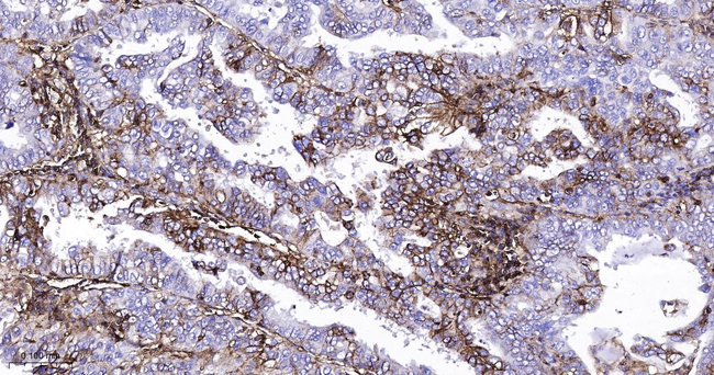 HLA-B Antibody in Immunohistochemistry (Paraffin) (IHC (P))