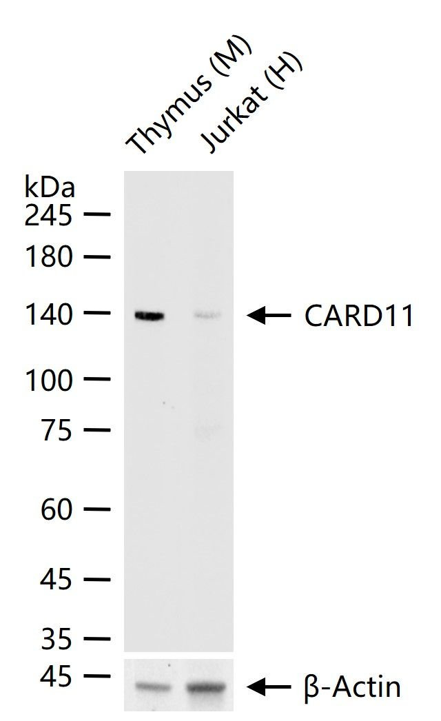 CARD11 Antibody in Western Blot (WB)