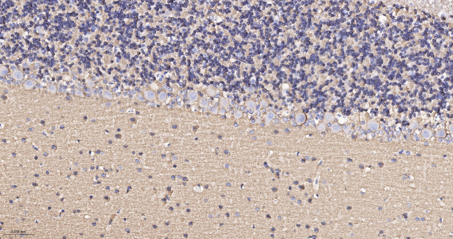 MUNC18 Antibody in Immunohistochemistry (Paraffin) (IHC (P))
