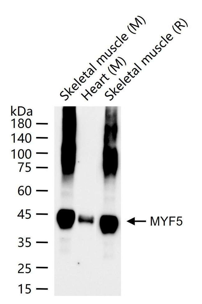MYF5 Antibody in Western Blot (WB)