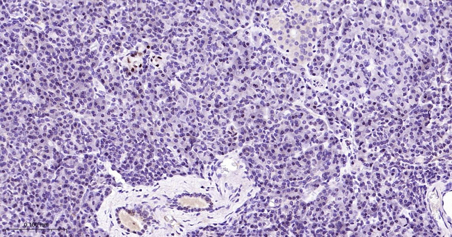 RCC1 Antibody in Immunohistochemistry (Paraffin) (IHC (P))
