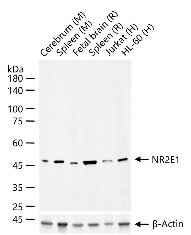 TLX Antibody in Western Blot (WB)