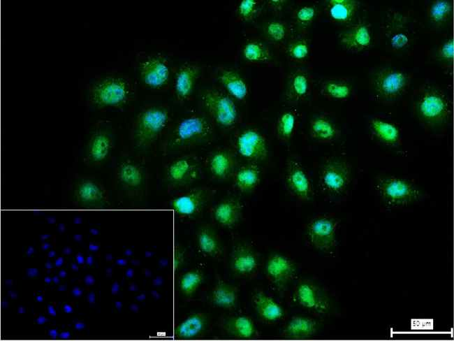 KIF4A Antibody in Immunocytochemistry (ICC/IF)