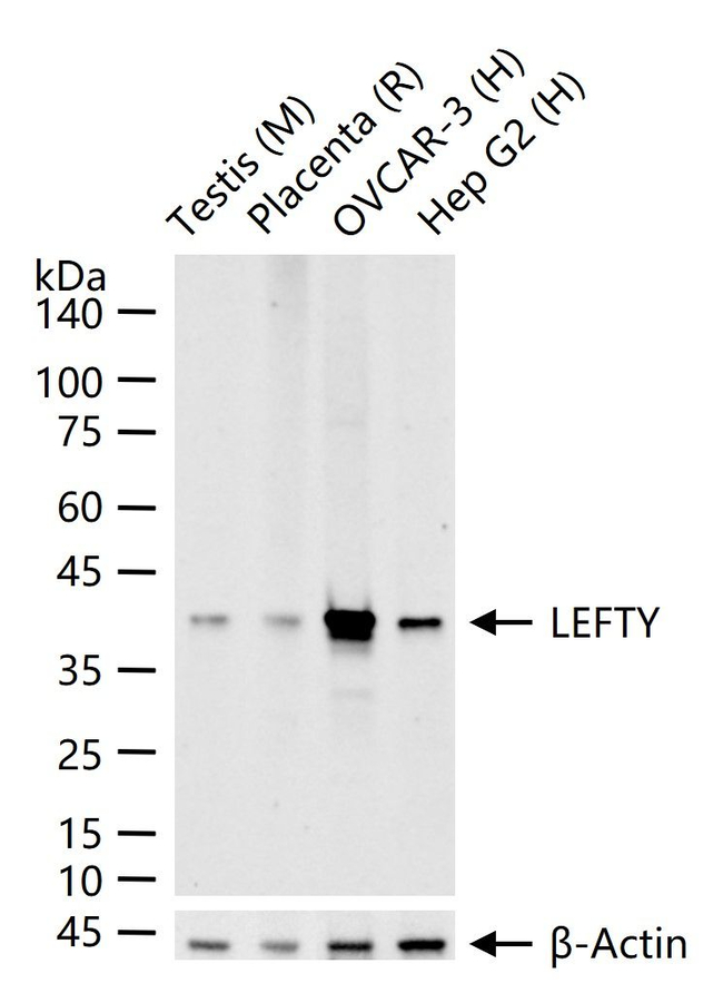 LEFTY Antibody in Western Blot (WB)