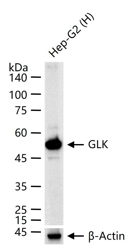 GCK Antibody in Western Blot (WB)