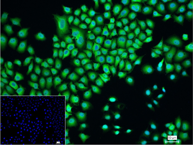 FOXF1 Antibody in Immunocytochemistry (ICC/IF)