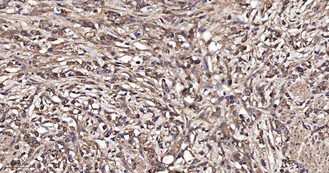 PLCG2 Antibody in Immunohistochemistry (Paraffin) (IHC (P))