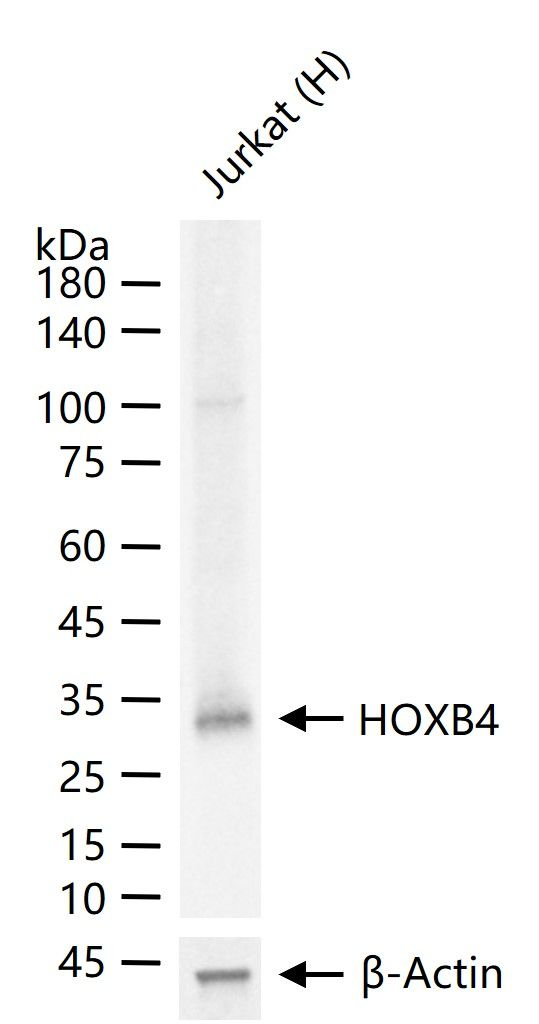 HOXB4 Antibody in Western Blot (WB)