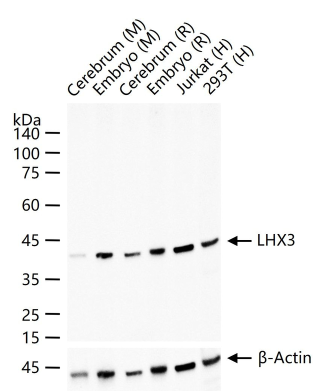 LHX3 Antibody in Western Blot (WB)