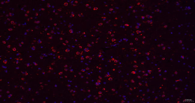 TMEFF2 Antibody in Immunohistochemistry (Paraffin) (IHC (P))
