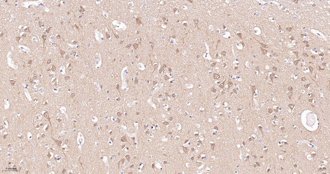 GSK3 alpha Antibody in Immunohistochemistry (Paraffin) (IHC (P))