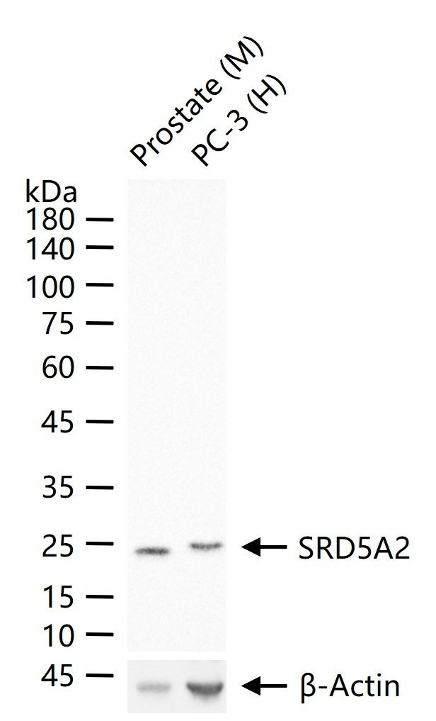 SRD5A2 Antibody in Western Blot (WB)