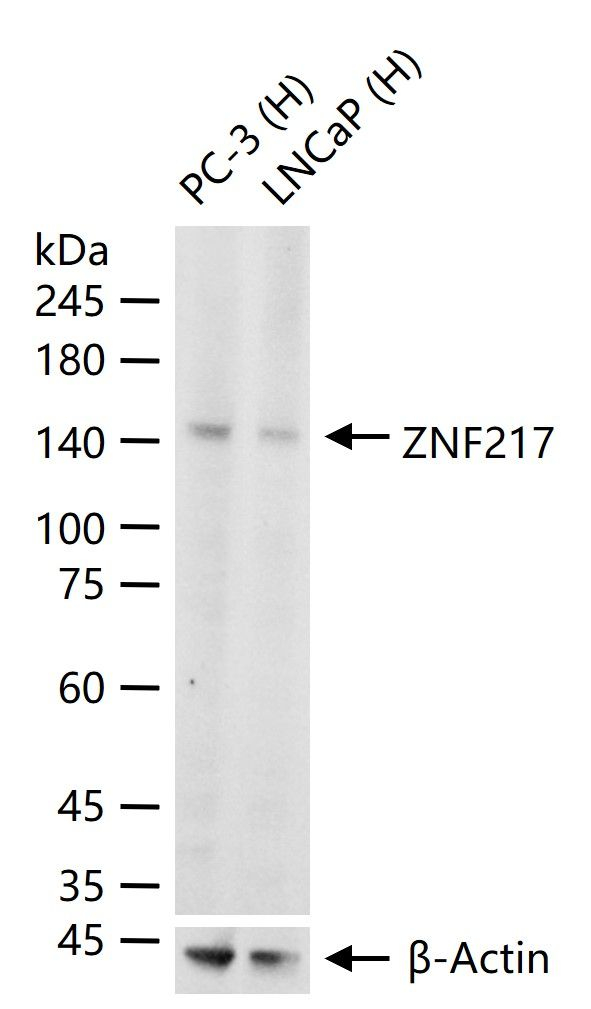 ZNF217 Antibody in Western Blot (WB)