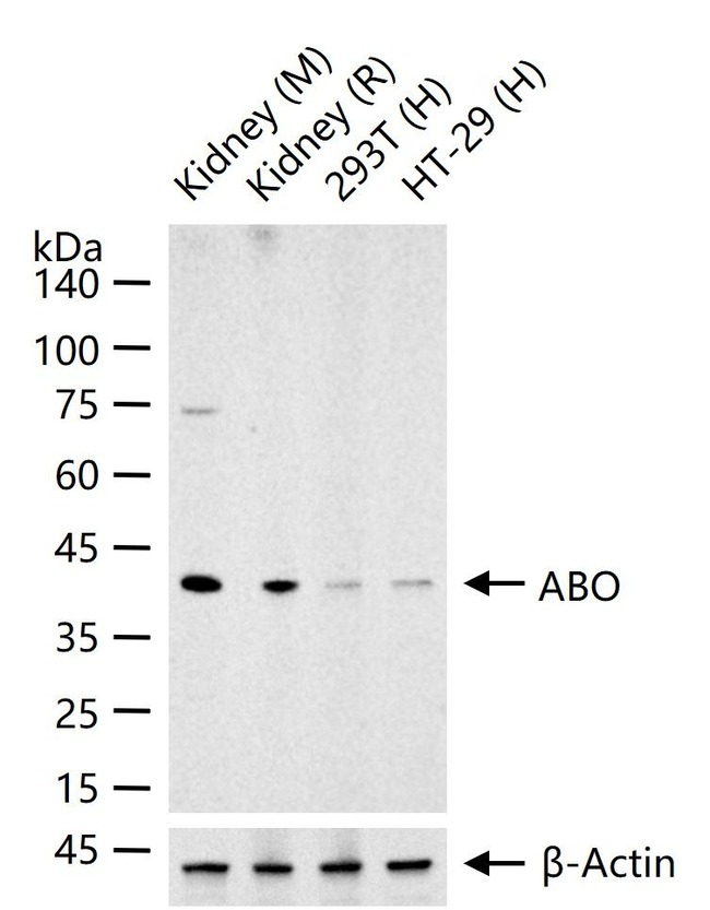 ABO Antibody in Western Blot (WB)