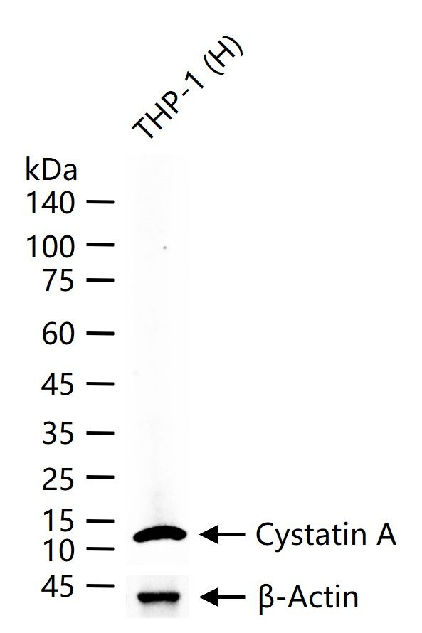 Cystatin A Antibody in Western Blot (WB)
