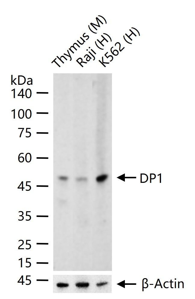 DP1 Antibody in Western Blot (WB)