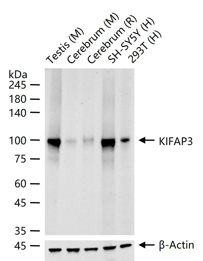 KAP3 Antibody in Western Blot (WB)