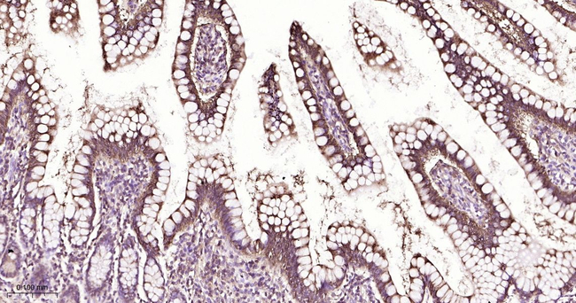 FABP2 Antibody in Immunohistochemistry (Paraffin) (IHC (P))