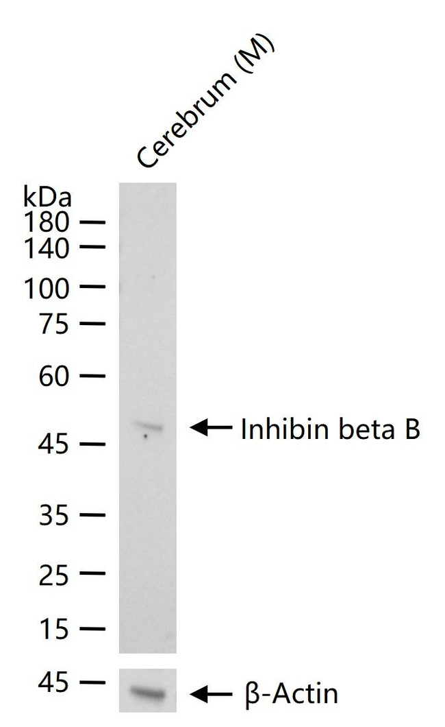 INHBB Antibody in Western Blot (WB)