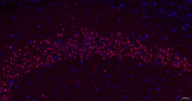 TCF4 Antibody in Immunohistochemistry (Paraffin) (IHC (P))