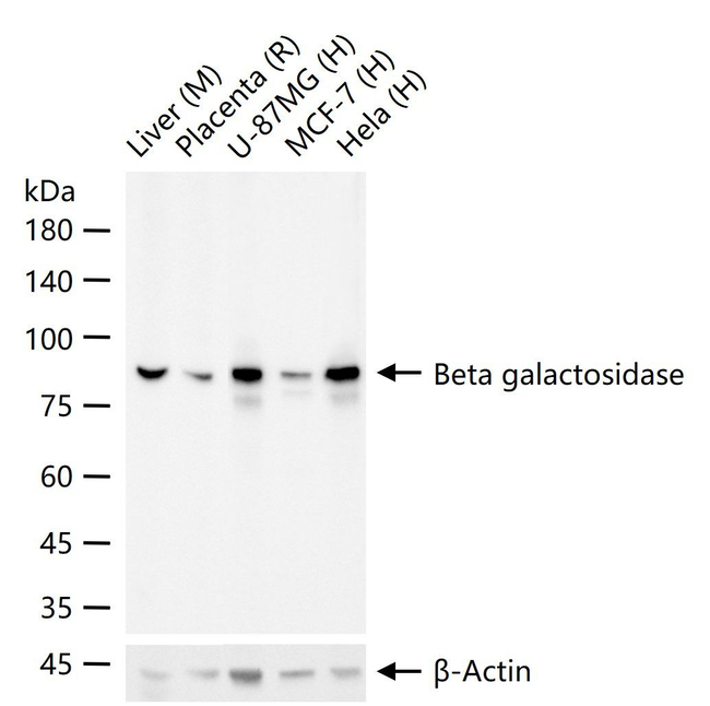 beta Galactosidase Antibody in Western Blot (WB)