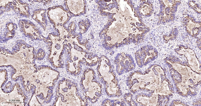 ARHGAP5 Antibody in Immunohistochemistry (Paraffin) (IHC (P))