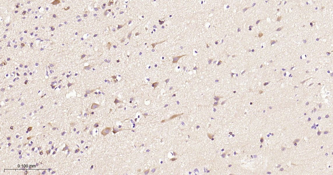 STK39 Antibody in Immunohistochemistry (Paraffin) (IHC (P))