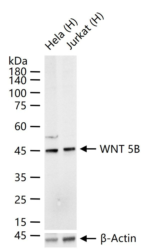 WNT5B Antibody in Western Blot (WB)