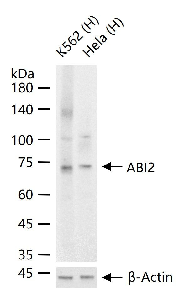 ABI2 Antibody in Western Blot (WB)