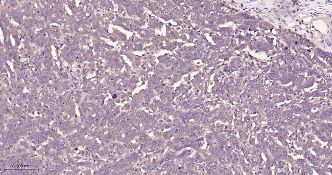 eIF3b Antibody in Immunohistochemistry (Paraffin) (IHC (P))