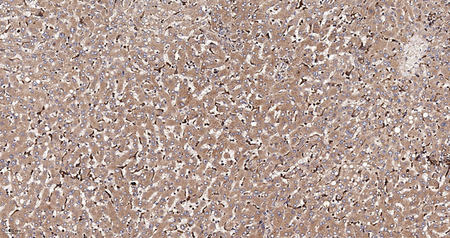 LCAT Antibody in Immunohistochemistry (Paraffin) (IHC (P))