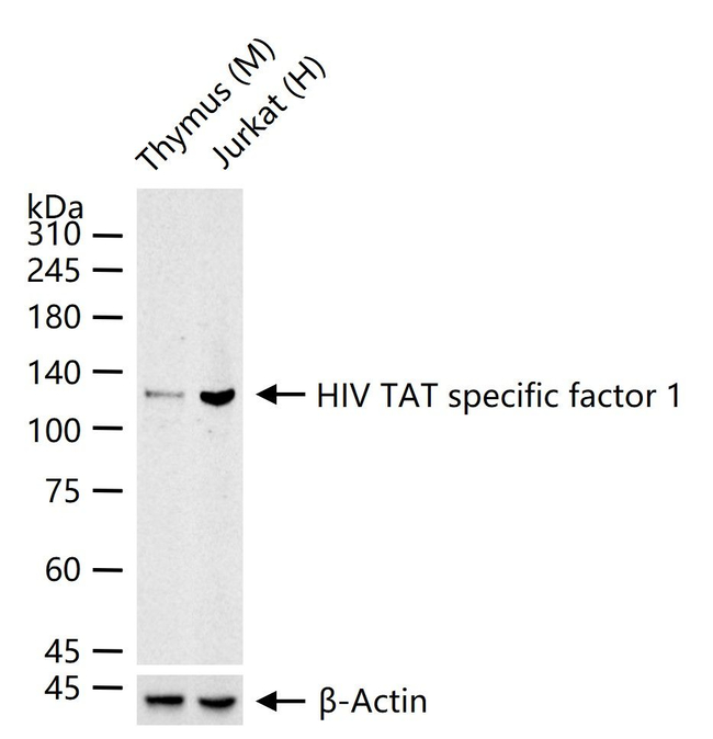 HTATSF1 Antibody in Western Blot (WB)