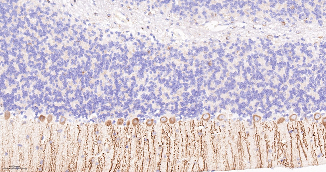LGI1 Antibody in Immunohistochemistry (Paraffin) (IHC (P))
