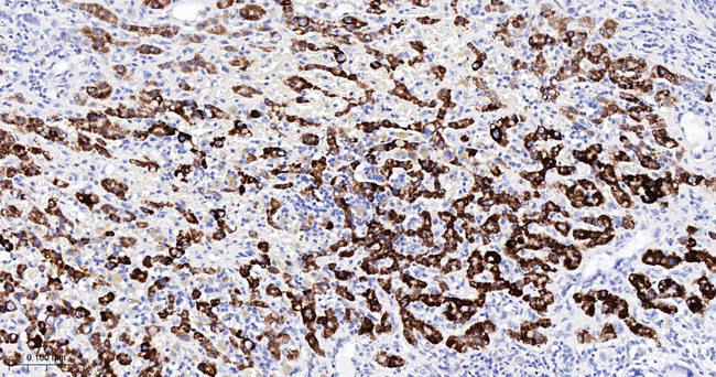 HMGCS2 Antibody in Immunohistochemistry (Paraffin) (IHC (P))