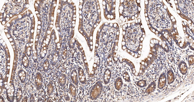 Arginase 2 Antibody in Immunohistochemistry (Paraffin) (IHC (P))