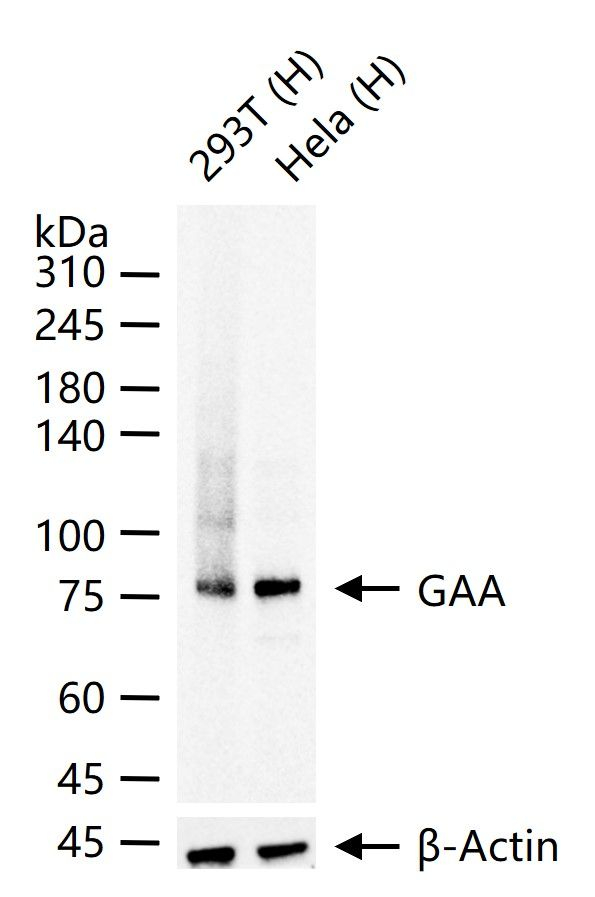GAA Antibody in Western Blot (WB)