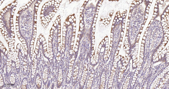 RACGAP1 Antibody in Immunohistochemistry (Paraffin) (IHC (P))