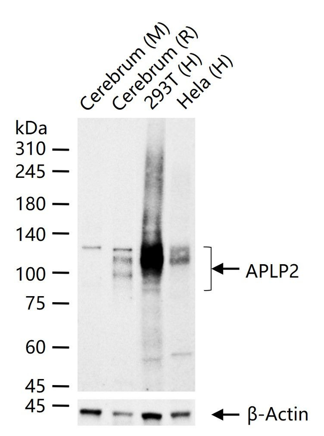APLP2 Antibody in Western Blot (WB)