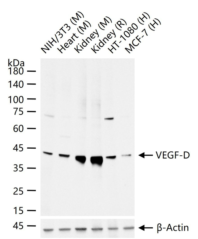 VEGFD Antibody in Western Blot (WB)