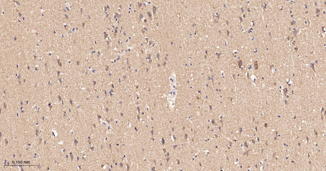 GOT2 Antibody in Immunohistochemistry (Paraffin) (IHC (P))