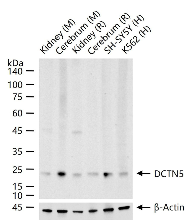 DCTN5 Antibody in Western Blot (WB)