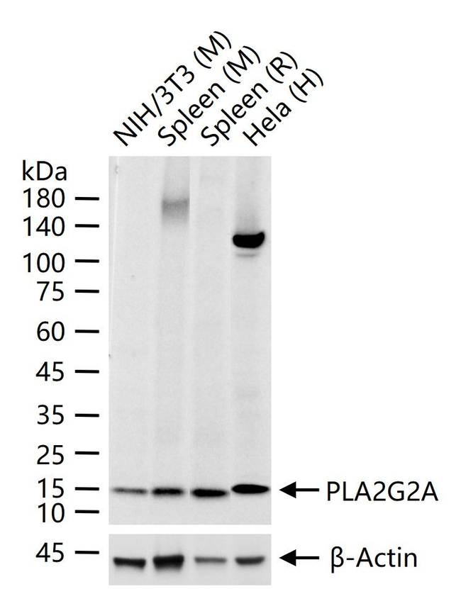 PLA2G2A Antibody in Western Blot (WB)