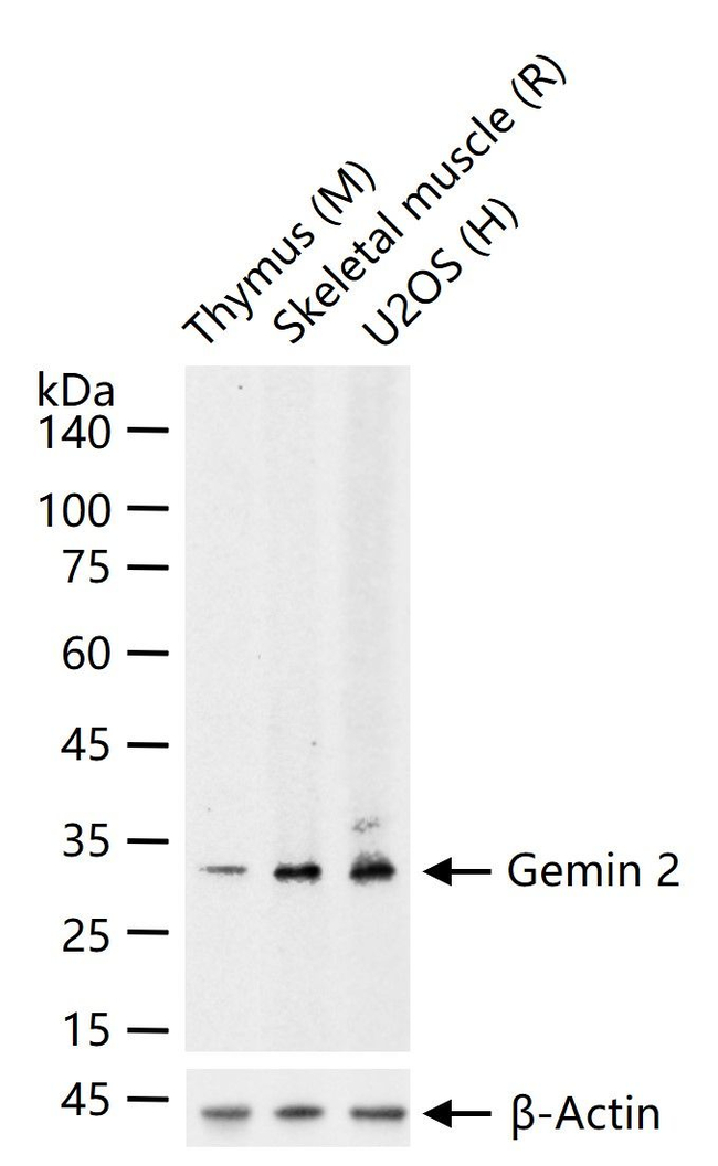 Gemin 2 Antibody in Western Blot (WB)