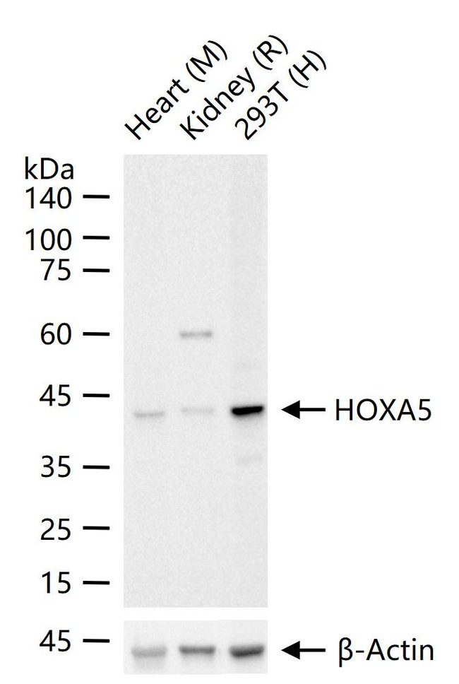 HOXA5 Antibody in Western Blot (WB)