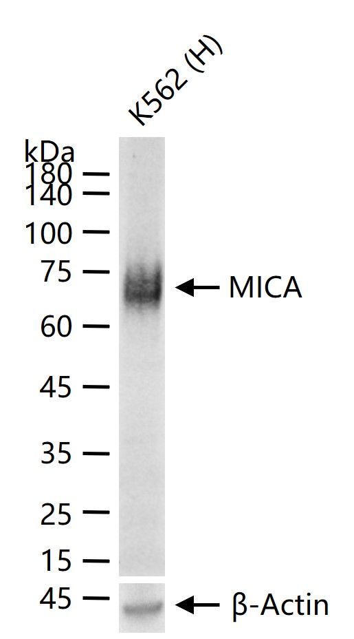 MICA Antibody in Western Blot (WB)