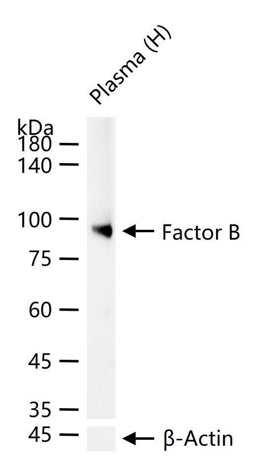Complement Factor B Antibody in Western Blot (WB)
