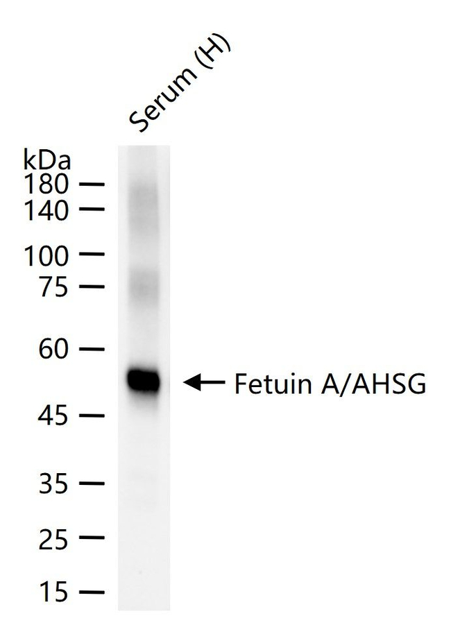Fetuin A Antibody in Western Blot (WB)