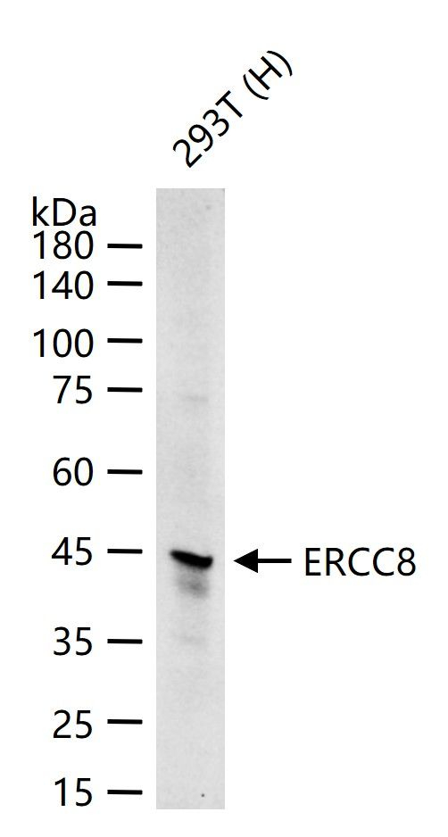 ERCC8 Antibody in Western Blot (WB)