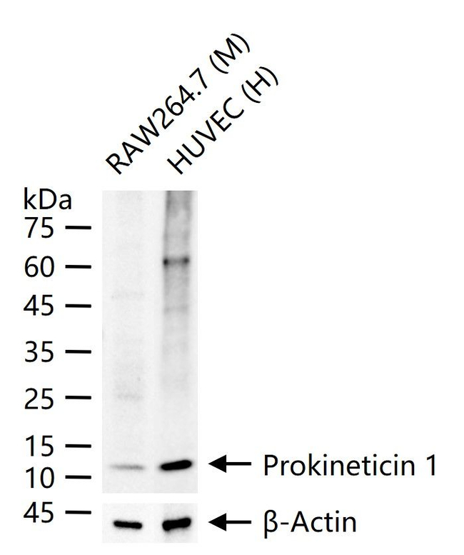 PROK1 Antibody in Western Blot (WB)