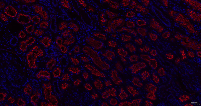 gamma Adaptin Antibody in Immunohistochemistry (Paraffin) (IHC (P))
